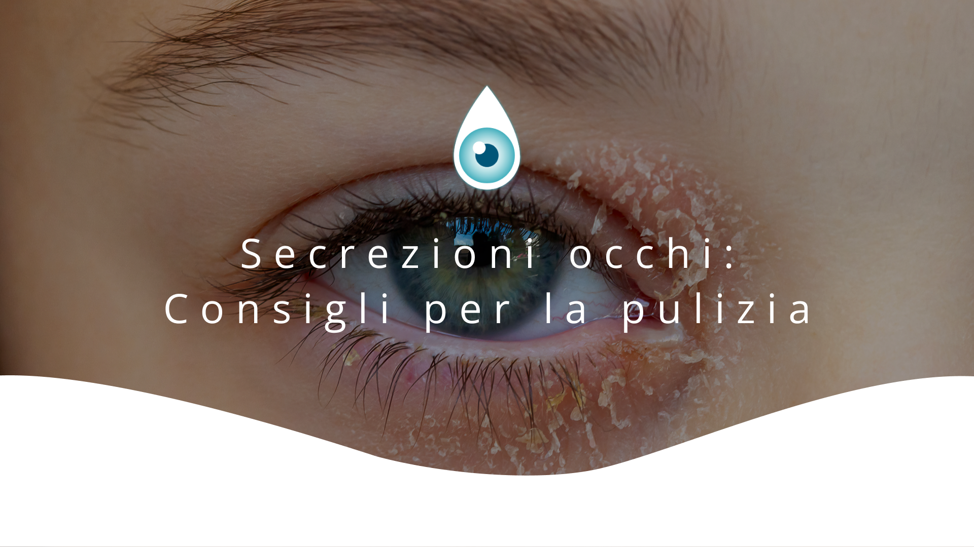 Copertina articolo con occhio in primo piano e secrezioni sulle palpebre